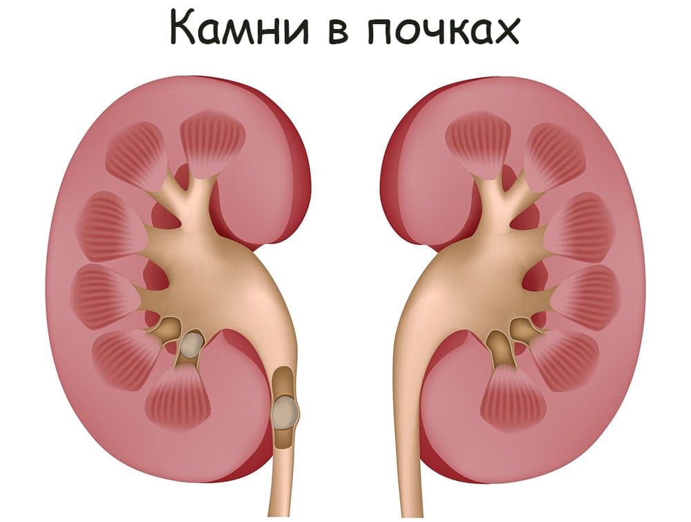 Как зайти в кракен с айфона